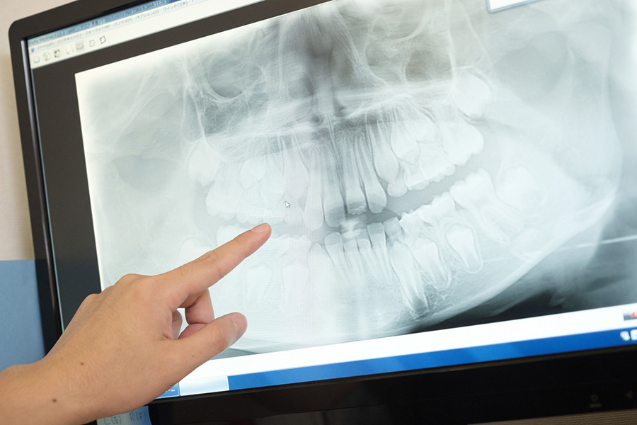 根管治療_当院の特徴_見える治療